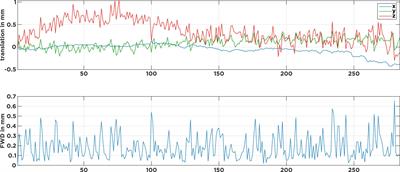 Evaluation of noise regression techniques in resting-state fMRI studies using data of 434 older adults